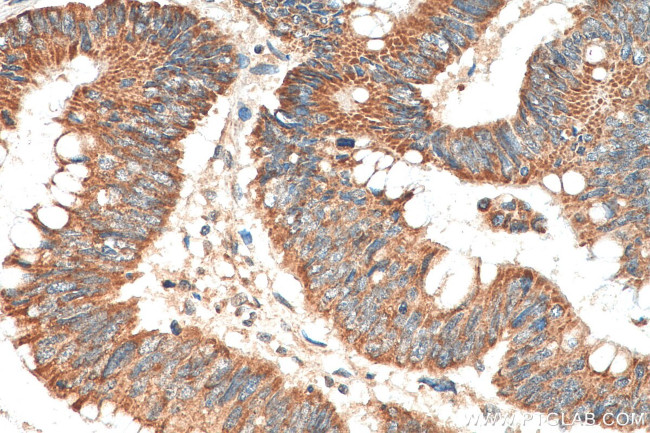 INO80 Antibody in Immunohistochemistry (Paraffin) (IHC (P))