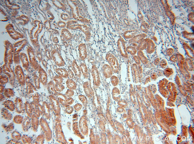 PSKH2 Antibody in Immunohistochemistry (Paraffin) (IHC (P))