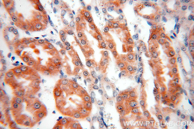 PSKH2 Antibody in Immunohistochemistry (Paraffin) (IHC (P))