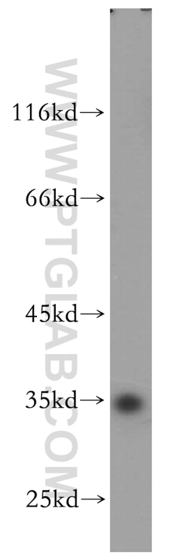 PSKH2 Antibody in Western Blot (WB)