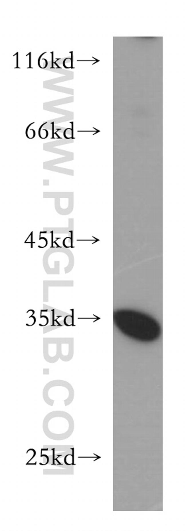 PSKH2 Antibody in Western Blot (WB)