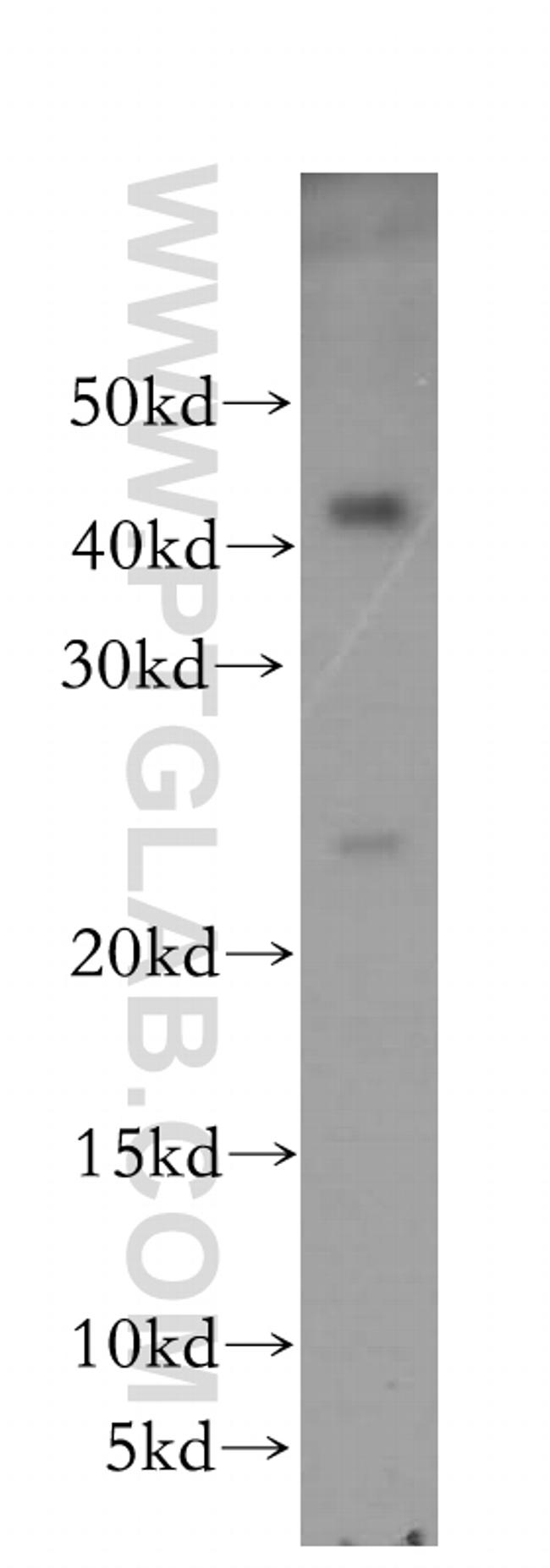 RAB41 Antibody in Western Blot (WB)