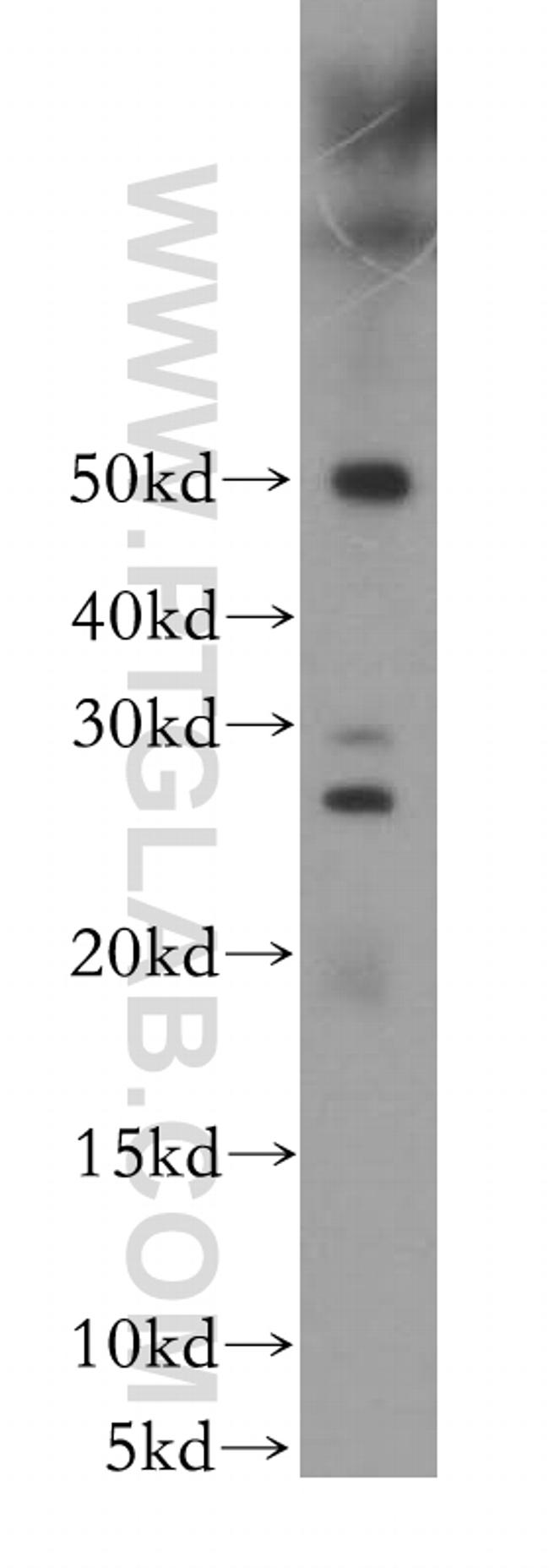 RAB41 Antibody in Western Blot (WB)