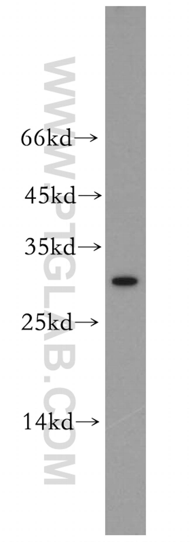 LILRA5 Antibody in Western Blot (WB)