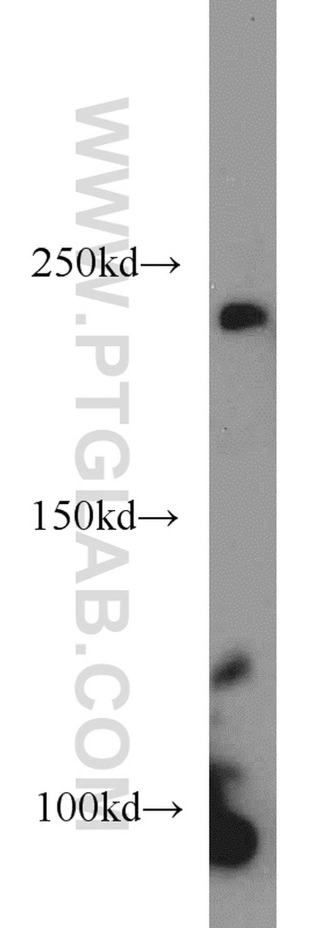 RBP2 Antibody in Western Blot (WB)