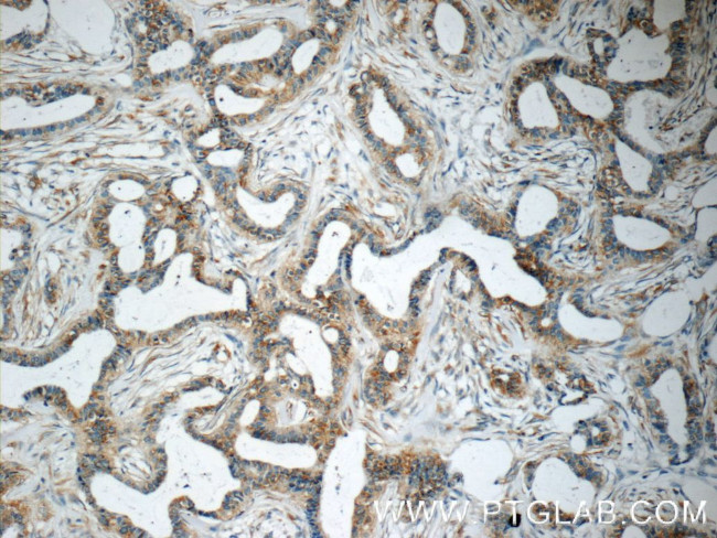 USP34 Antibody in Immunohistochemistry (Paraffin) (IHC (P))