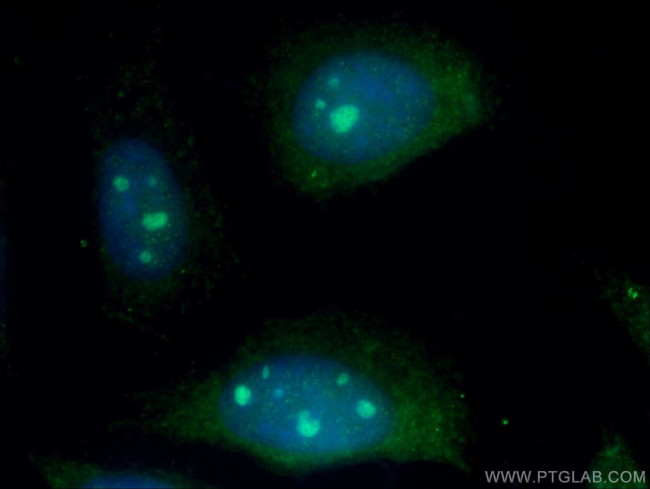 1A6/DRIM Antibody in Immunocytochemistry (ICC/IF)