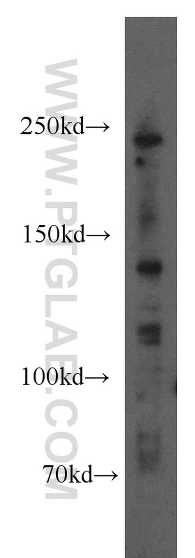 1A6/DRIM Antibody in Western Blot (WB)