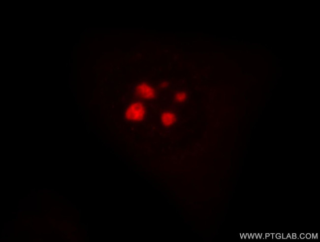 1A6/DRIM Antibody in Immunocytochemistry (ICC/IF)