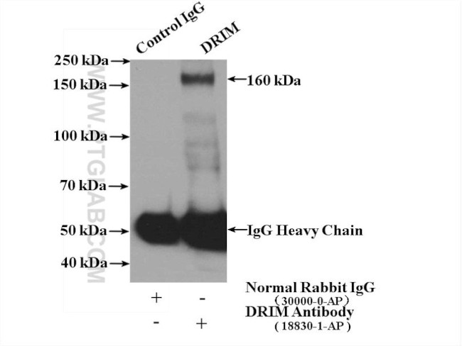 1A6/DRIM Antibody in Immunoprecipitation (IP)