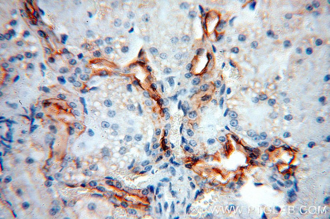 ARHGAP24 Antibody in Immunohistochemistry (Paraffin) (IHC (P))