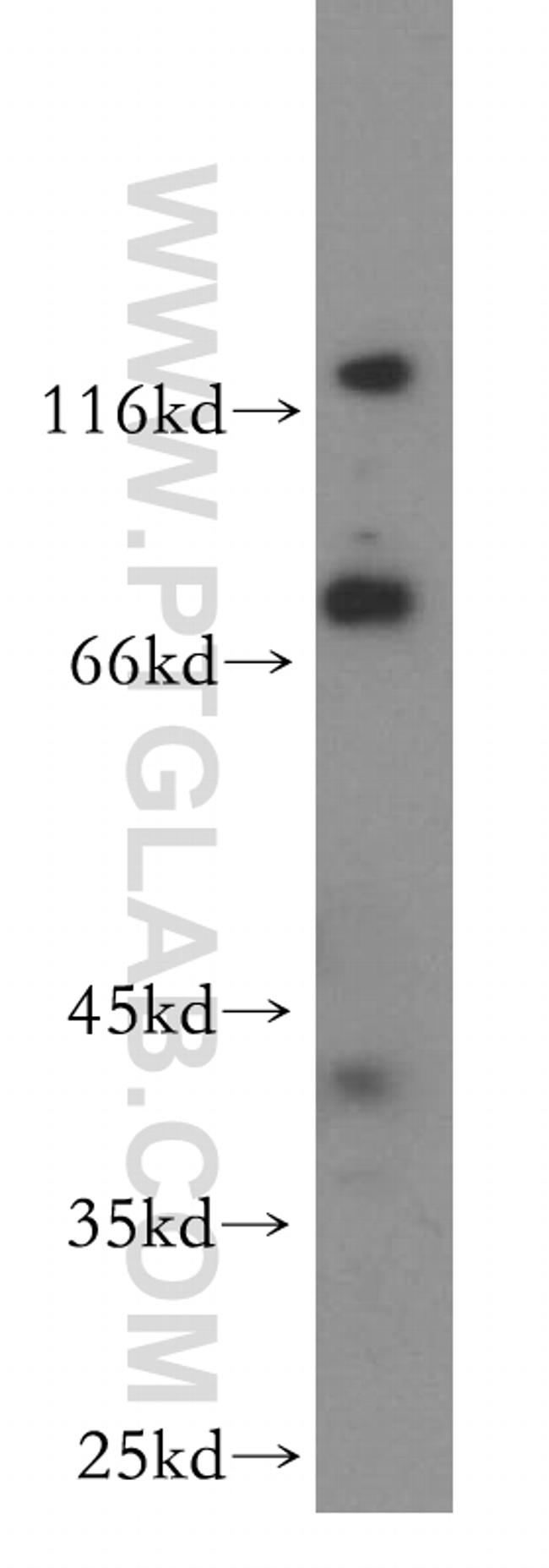 ARHGAP24 Antibody in Western Blot (WB)