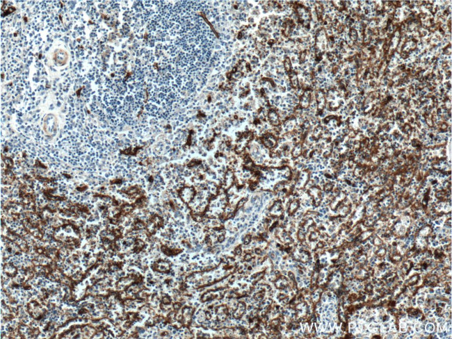 CD36 Antibody in Immunohistochemistry (Paraffin) (IHC (P))