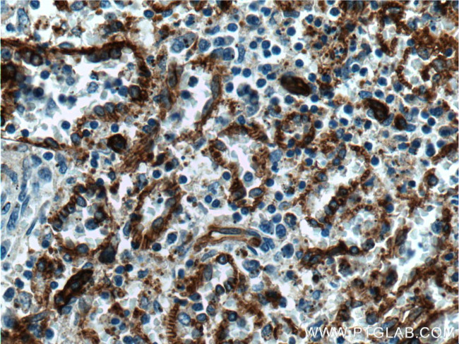 CD36 Antibody in Immunohistochemistry (Paraffin) (IHC (P))