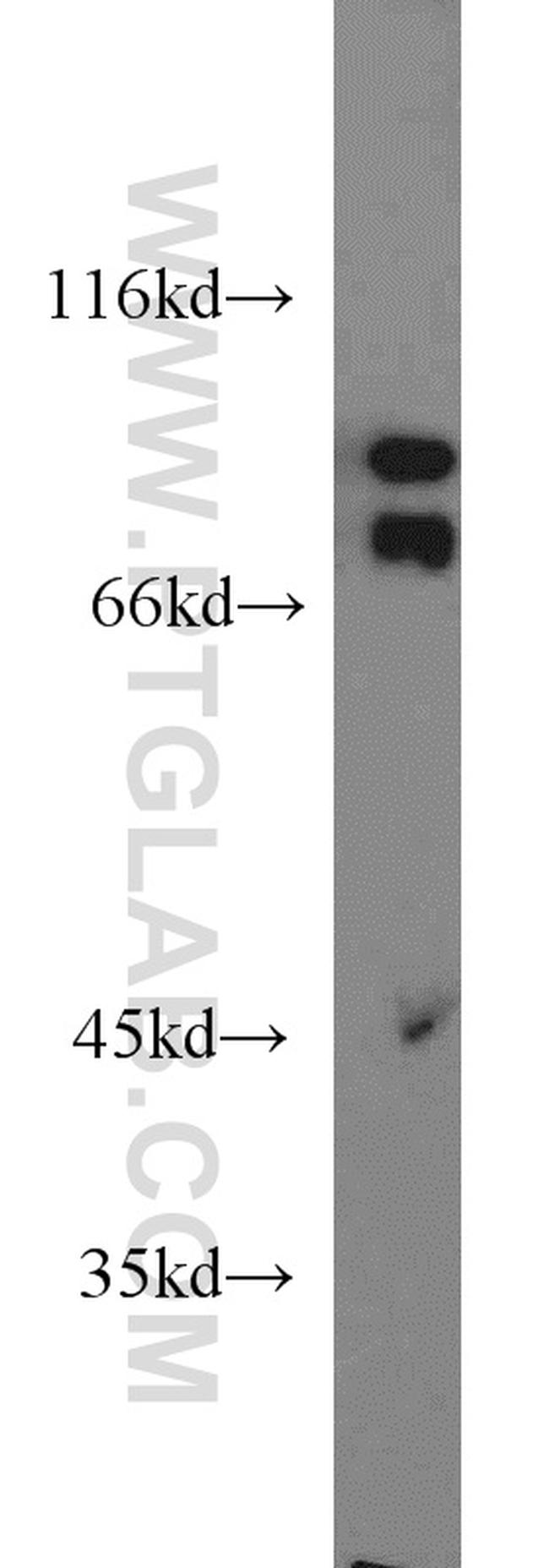 CD36 Antibody in Western Blot (WB)