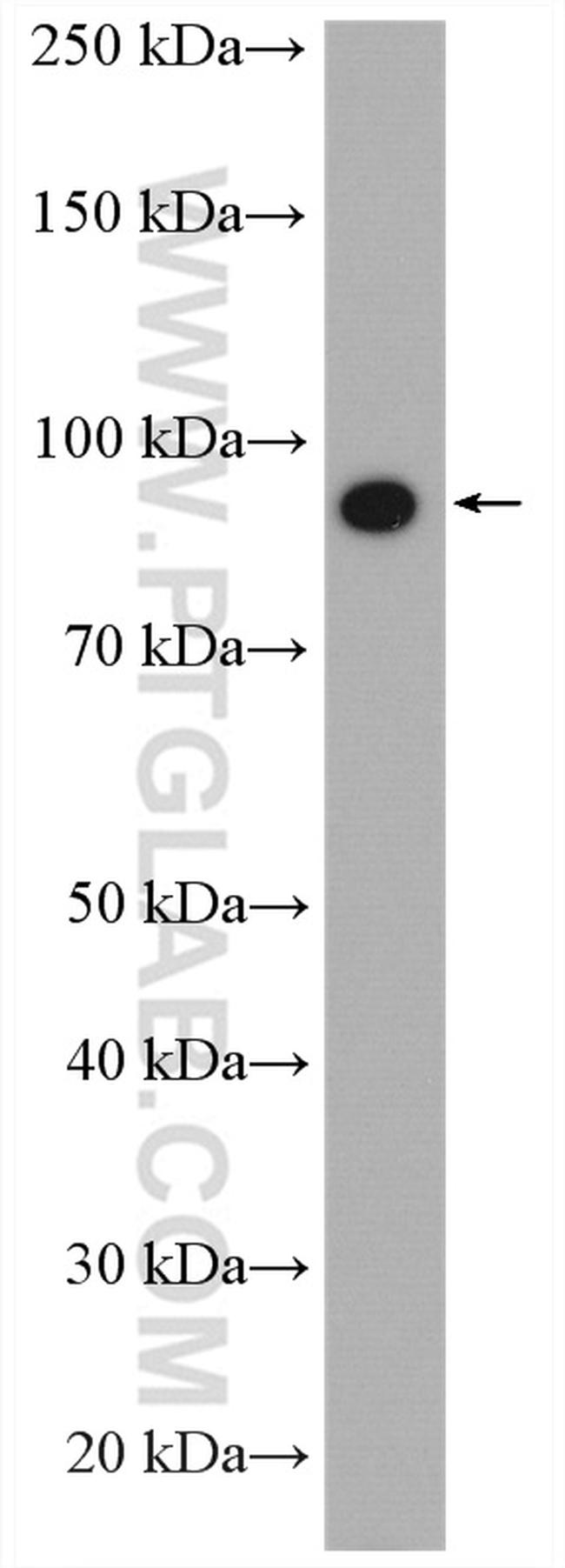 CD36 Antibody in Western Blot (WB)