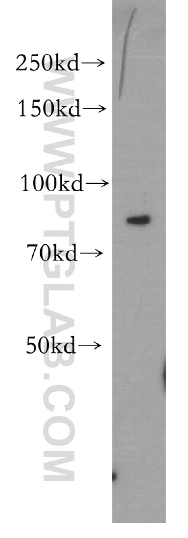 CD36 Antibody in Western Blot (WB)