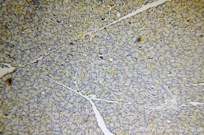 USP32 Antibody in Immunohistochemistry (Paraffin) (IHC (P))