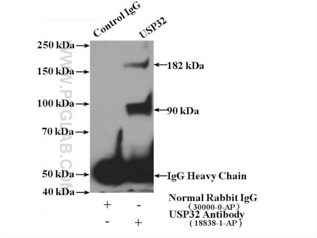 USP32 Antibody in Immunoprecipitation (IP)