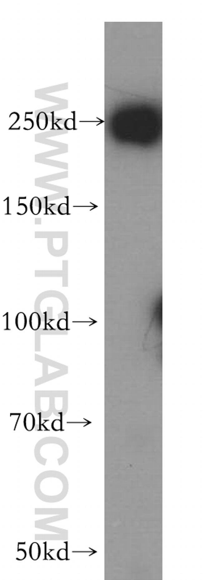 USP32 Antibody in Western Blot (WB)