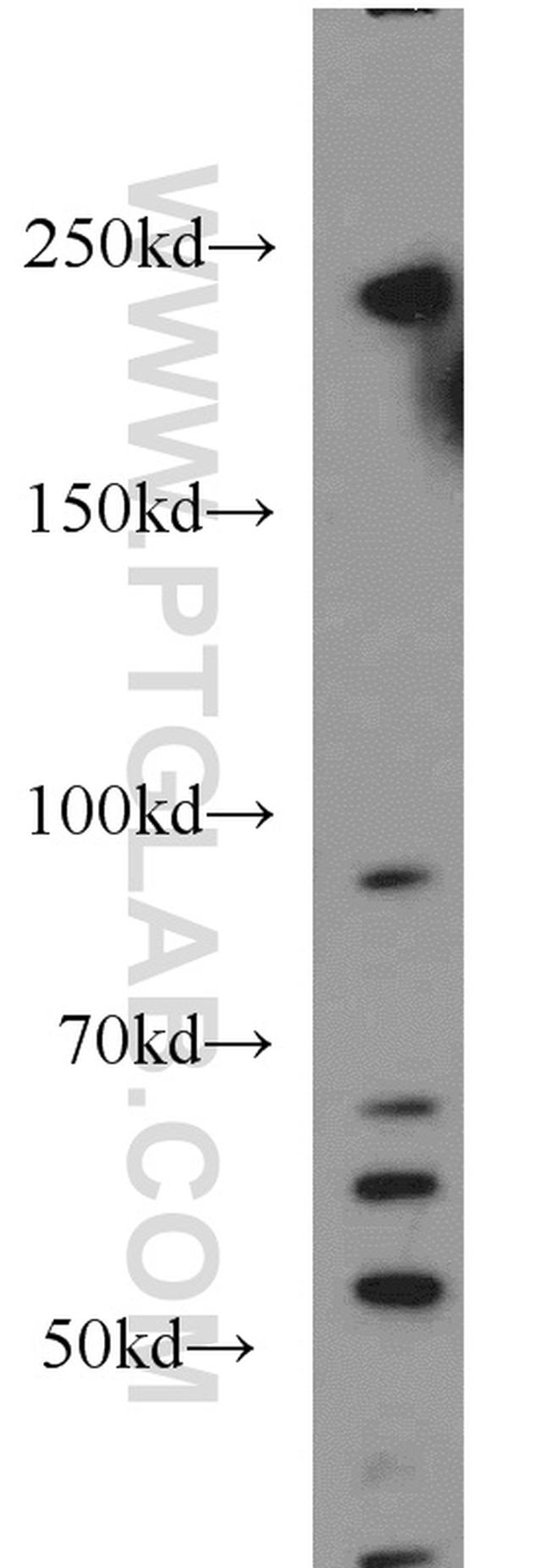 USP32 Antibody in Western Blot (WB)