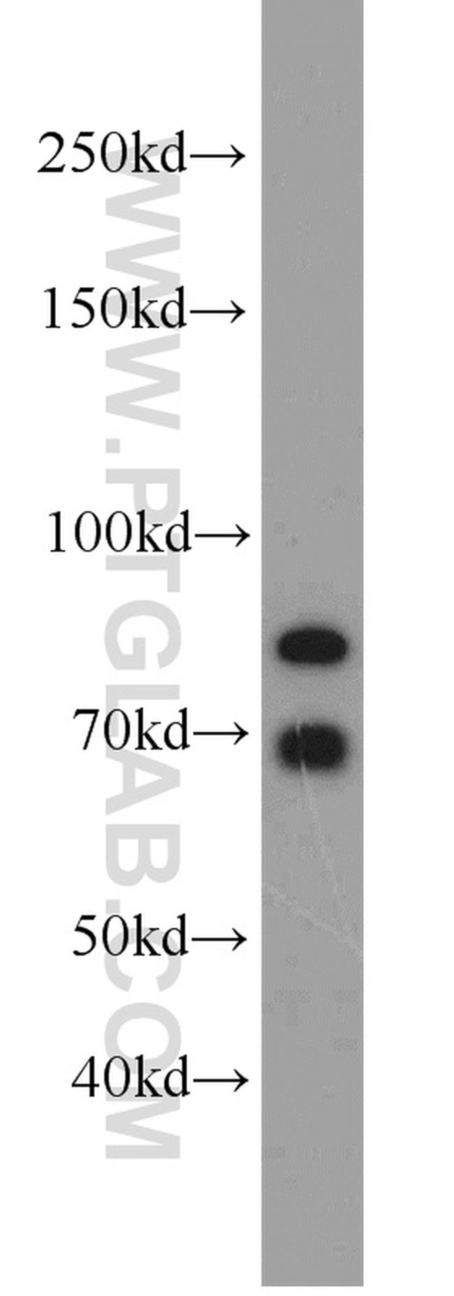 SORCS1 Antibody in Western Blot (WB)