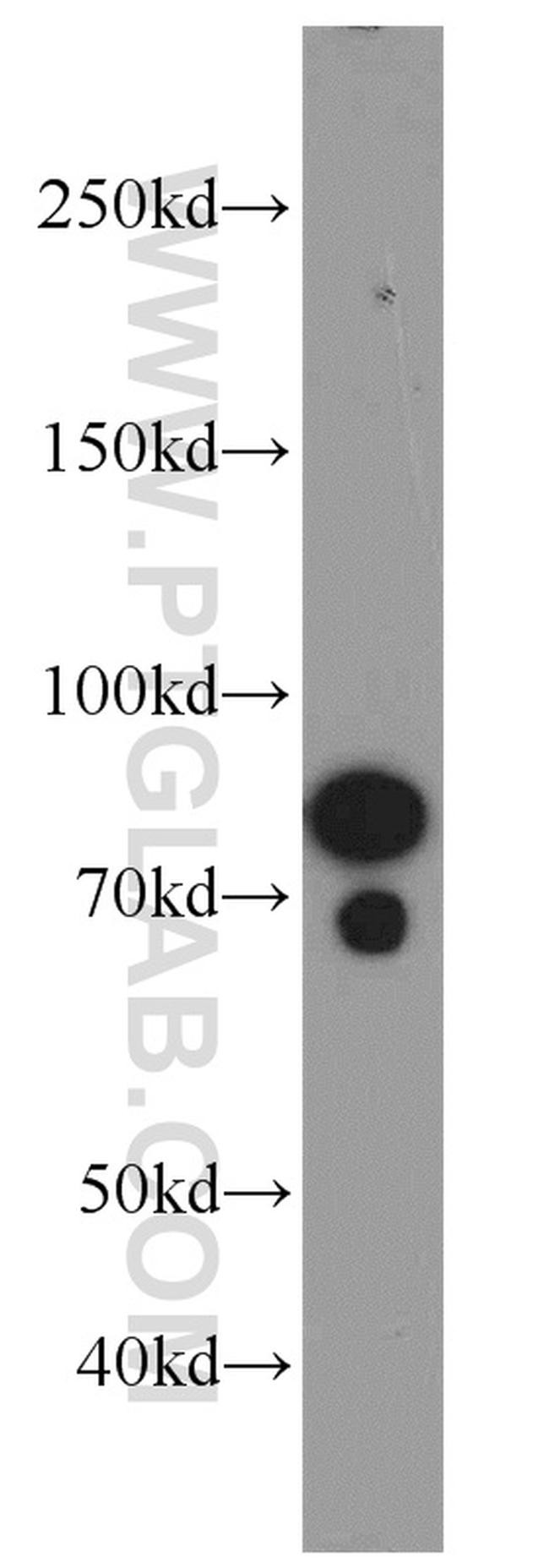 SORCS1 Antibody in Western Blot (WB)