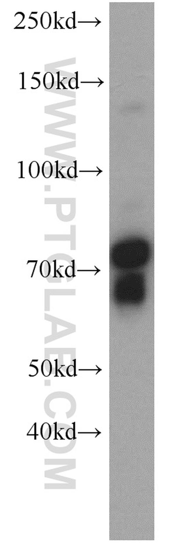 SORCS1 Antibody in Western Blot (WB)