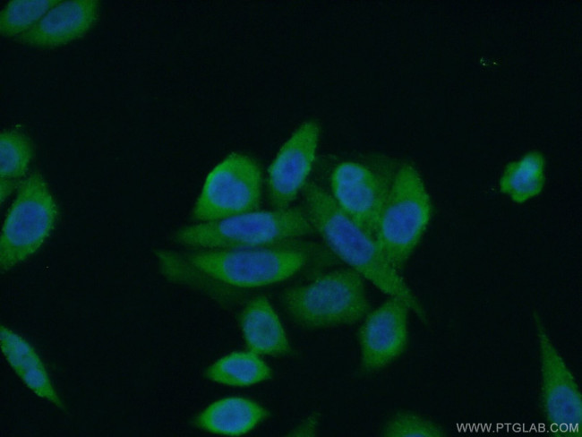 RAB12 Antibody in Immunocytochemistry (ICC/IF)