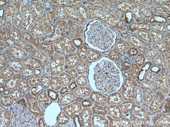 RAB12 Antibody in Immunohistochemistry (Paraffin) (IHC (P))