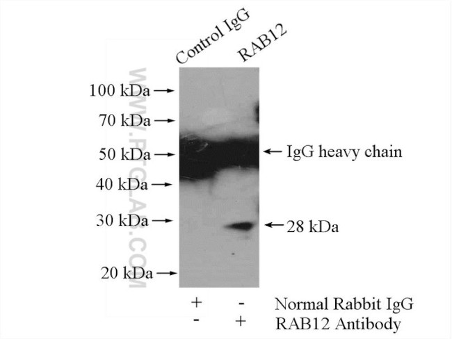 RAB12 Antibody in Immunoprecipitation (IP)