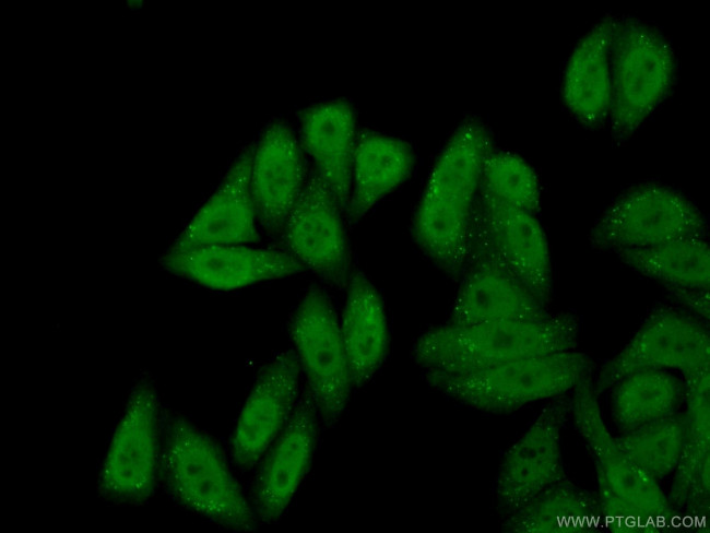 IRF2BP2 Antibody in Immunocytochemistry (ICC/IF)