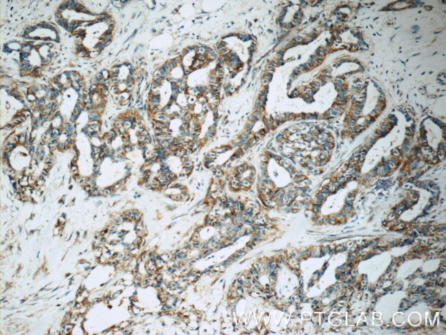 IRF2BP2 Antibody in Immunohistochemistry (Paraffin) (IHC (P))