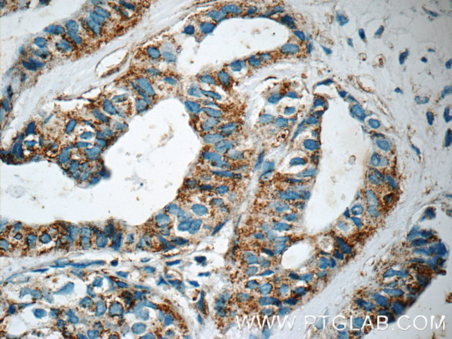 IRF2BP2 Antibody in Immunohistochemistry (Paraffin) (IHC (P))