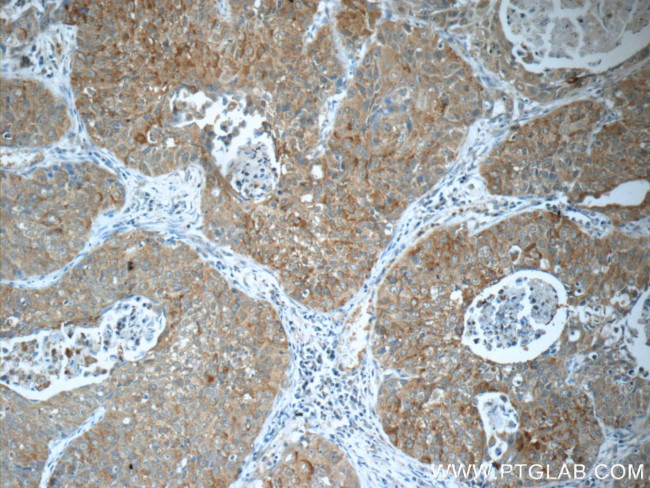 IRF2BP2 Antibody in Immunohistochemistry (Paraffin) (IHC (P))