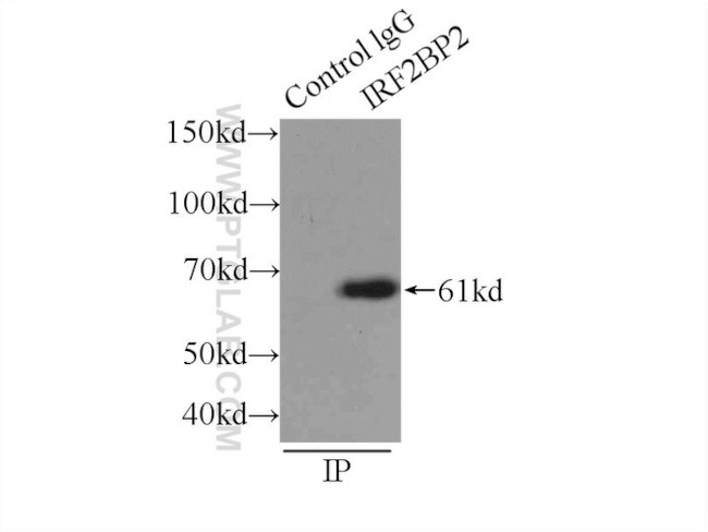 IRF2BP2 Antibody in Immunoprecipitation (IP)