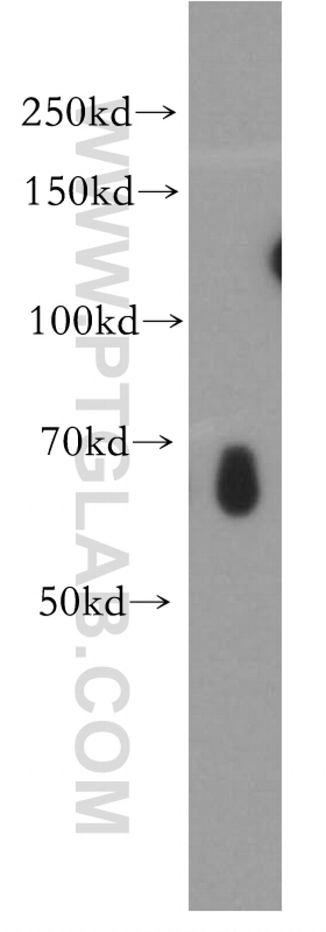 IRF2BP2 Antibody in Western Blot (WB)