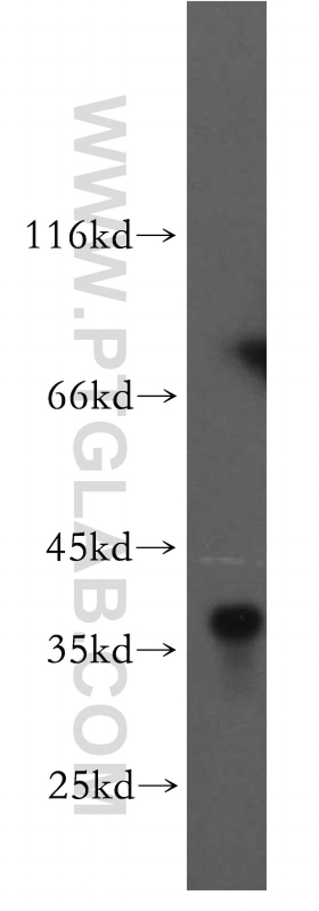 AKR1C4 Antibody in Western Blot (WB)