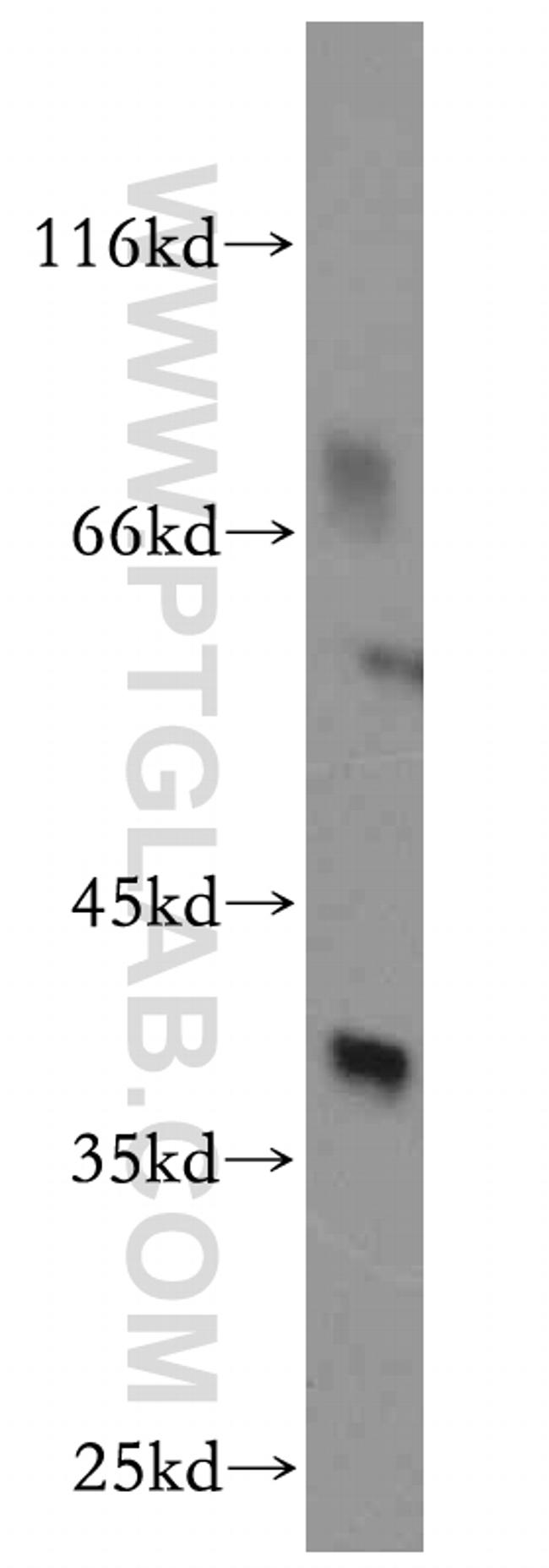 AKR1C4 Antibody in Western Blot (WB)