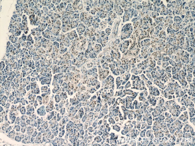 UBR2 Antibody in Immunohistochemistry (Paraffin) (IHC (P))