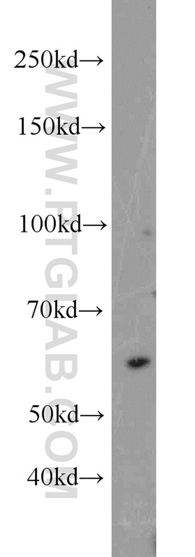 UBR2 Antibody in Western Blot (WB)