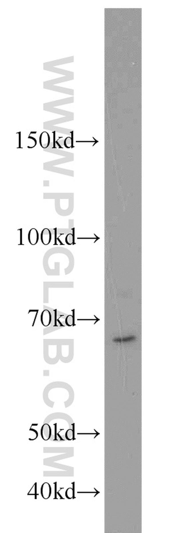 UBR2 Antibody in Western Blot (WB)