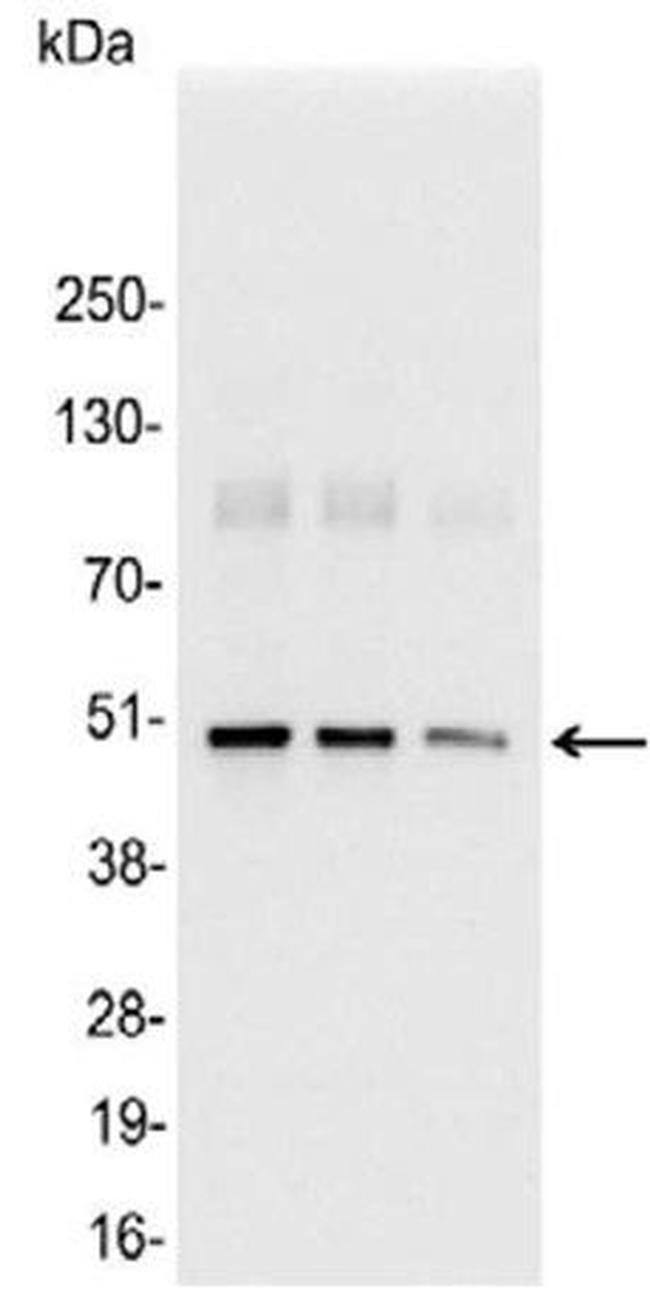 KT3 Antibody in Western Blot (WB)