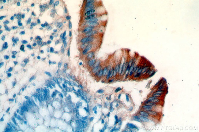 PCYOX1 Antibody in Immunohistochemistry (Paraffin) (IHC (P))