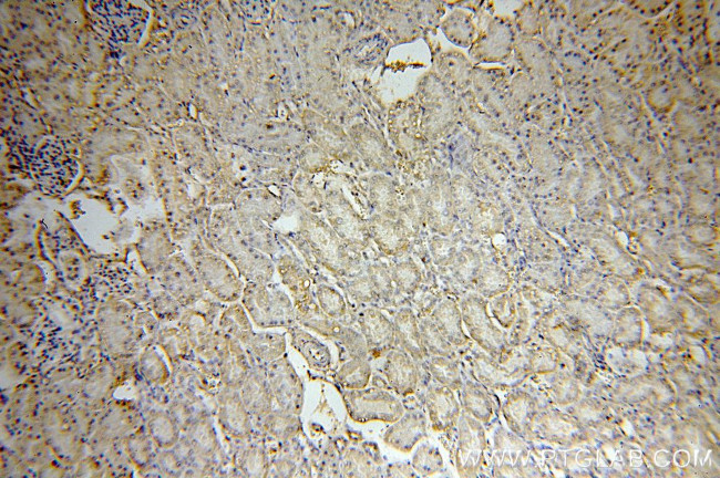 MRPS17 Antibody in Immunohistochemistry (Paraffin) (IHC (P))