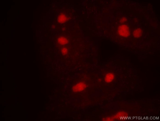 UTP3 Antibody in Immunocytochemistry (ICC/IF)