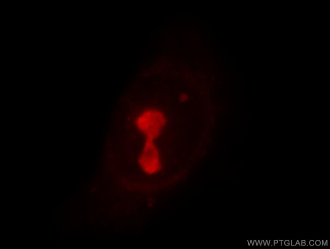 UTP3 Antibody in Immunocytochemistry (ICC/IF)