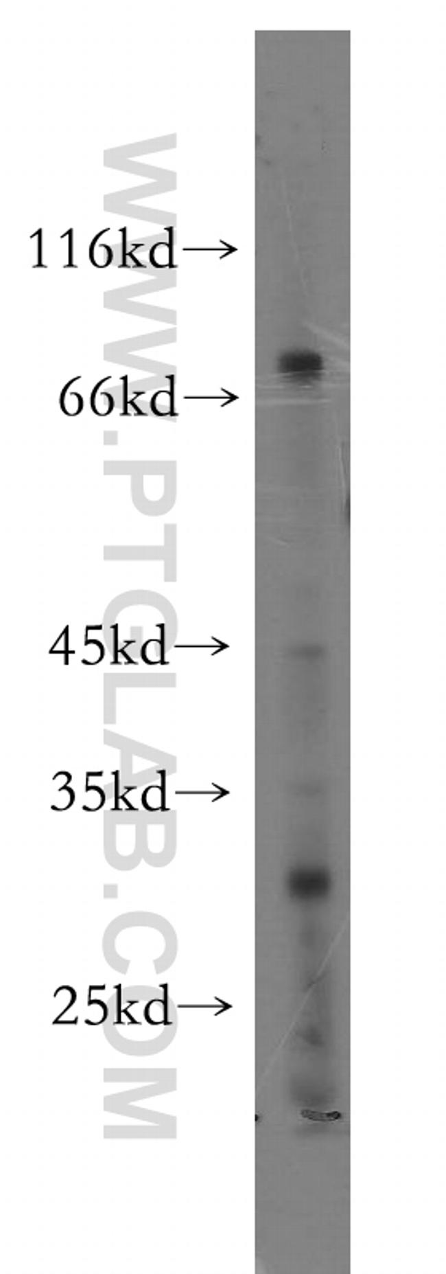 UTP3 Antibody in Western Blot (WB)