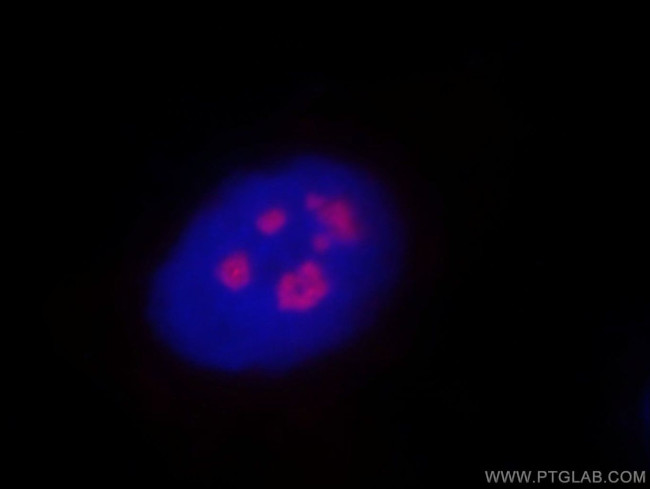 REXO4 Antibody in Immunocytochemistry (ICC/IF)