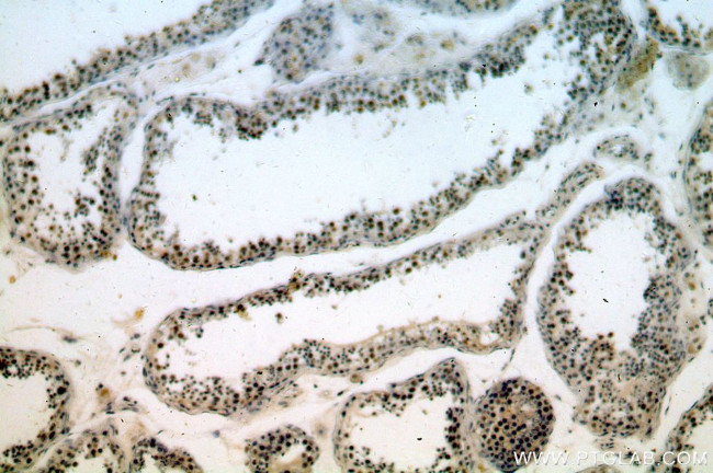 REXO4 Antibody in Immunohistochemistry (Paraffin) (IHC (P))